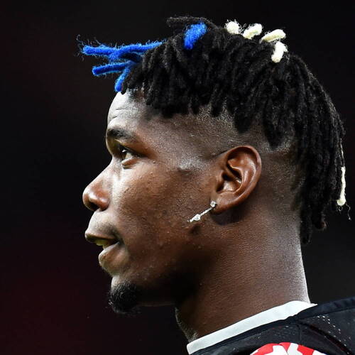 France nouveau pépin physique pour Pogba